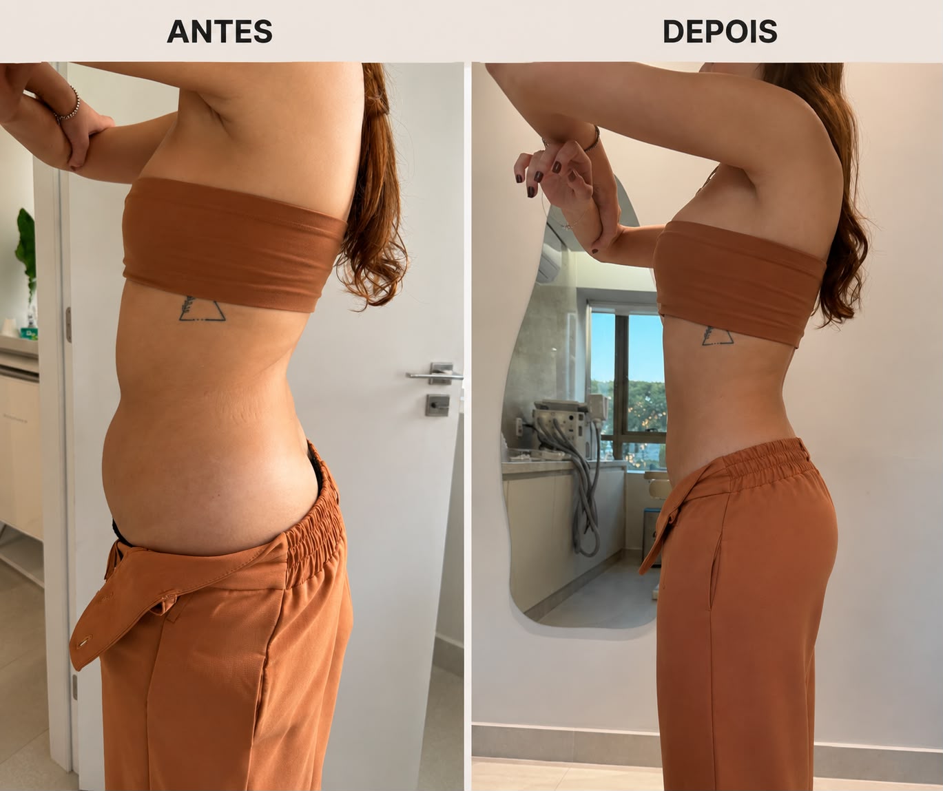 Comparação de antes e depois de acompanhamento nutrológico, perfil lateral